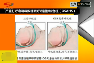 严重打呼噜可导致睡眠呼吸暂停综合征