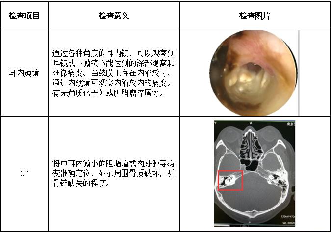 中耳炎的检查项目