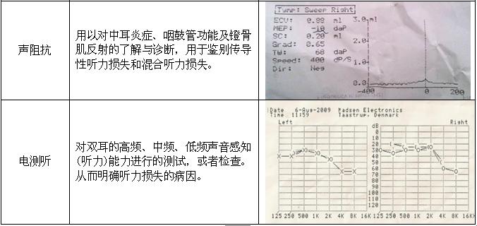 中耳炎的检查项目