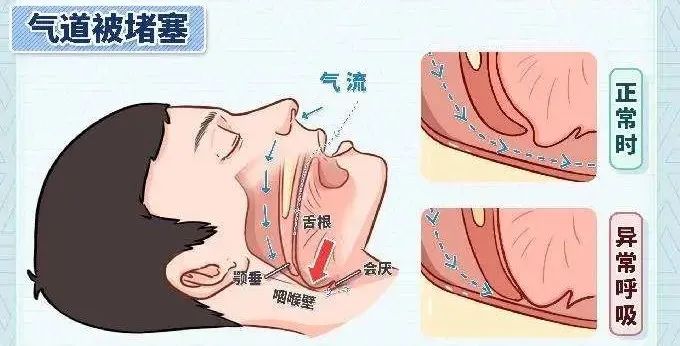 重庆耳鼻喉医院