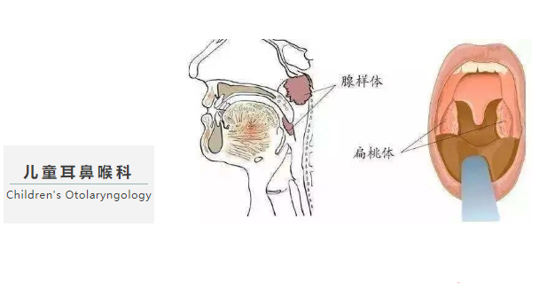 重庆仁品耳鼻喉医院-儿童耳鼻喉科