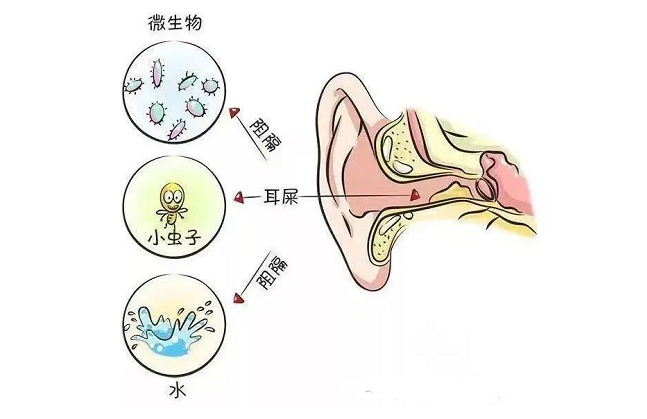 耵聍栓塞