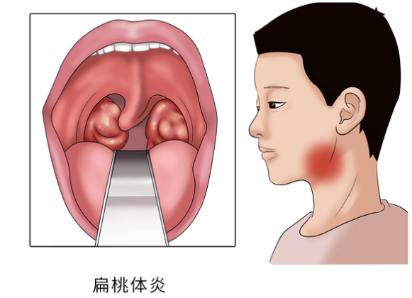 重庆咽喉科医院