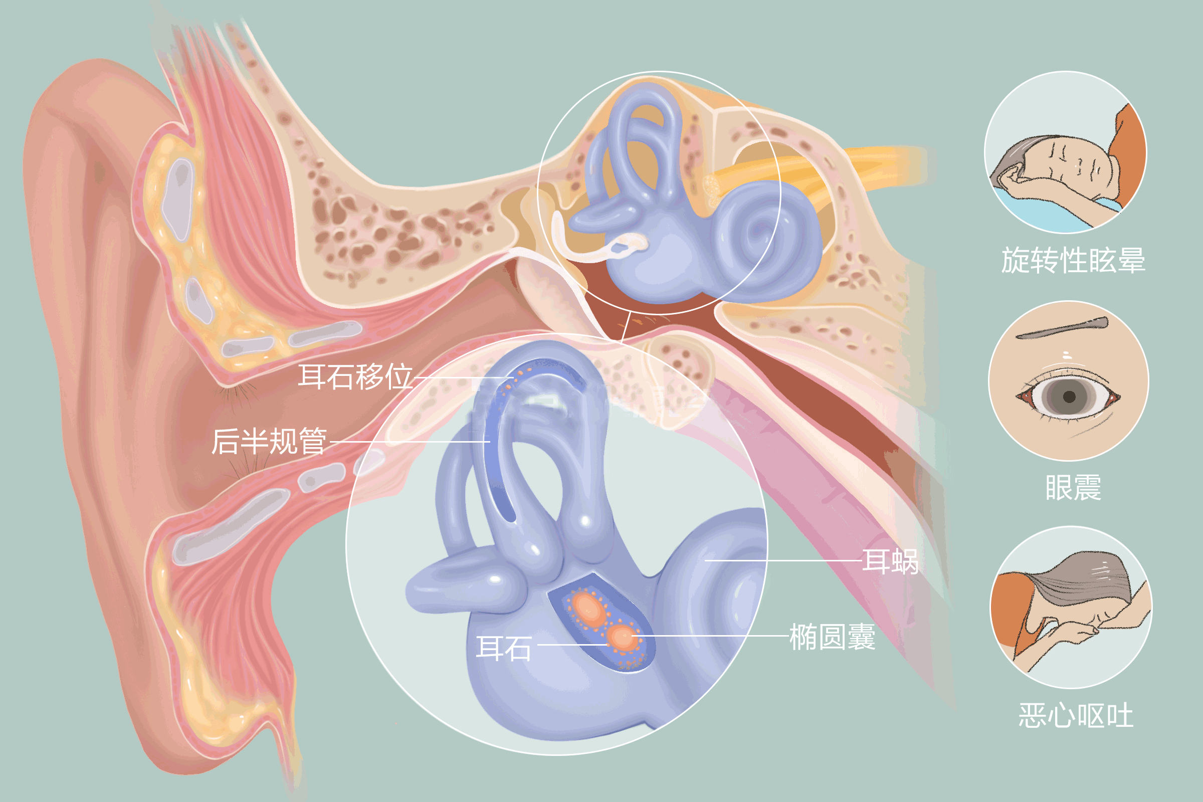 重庆治疗耳石症医院