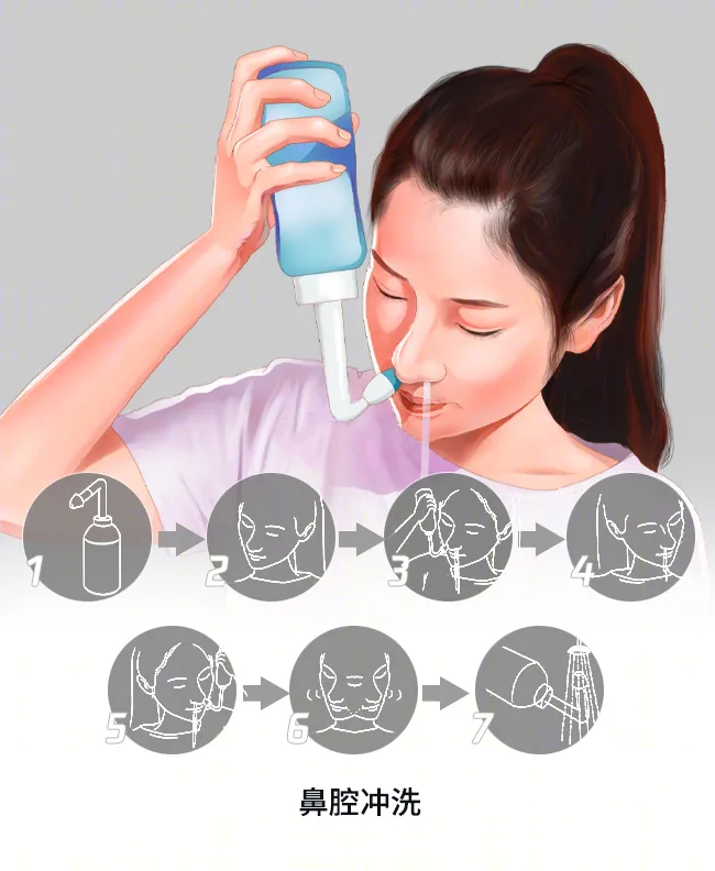 鼻喷雾剂的正确使用方法