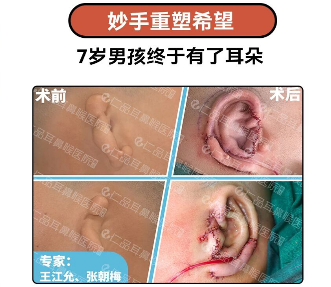 仁品医院正式启动小耳畸形寒假专